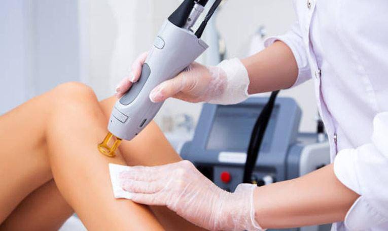 What-is-the-best-laser-hair-removal-machine