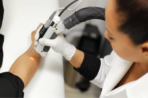 لیزر موهای زائد و معرفی جدید ترین دستگاه ها برای رفع آن