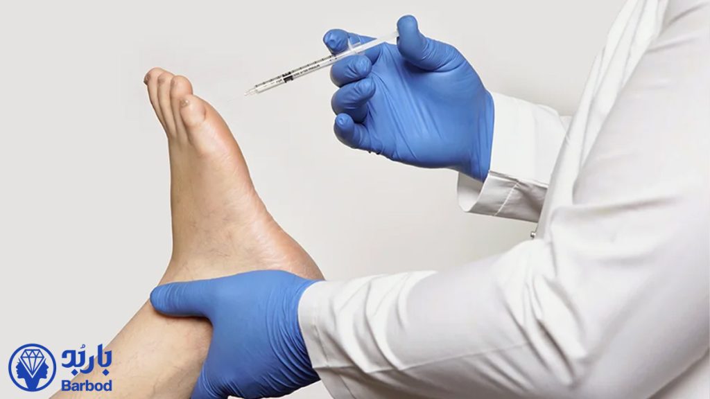 بوتاکس کف پا برای جلوگیری از تعریق پا