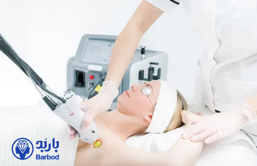 عوارض-لیزر-موهای-زائد