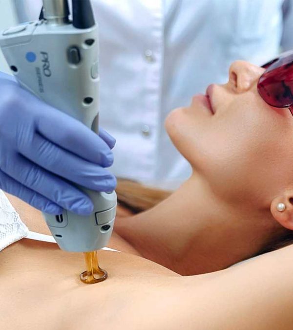 لیزر موهای زائد زیر بغل در تهران