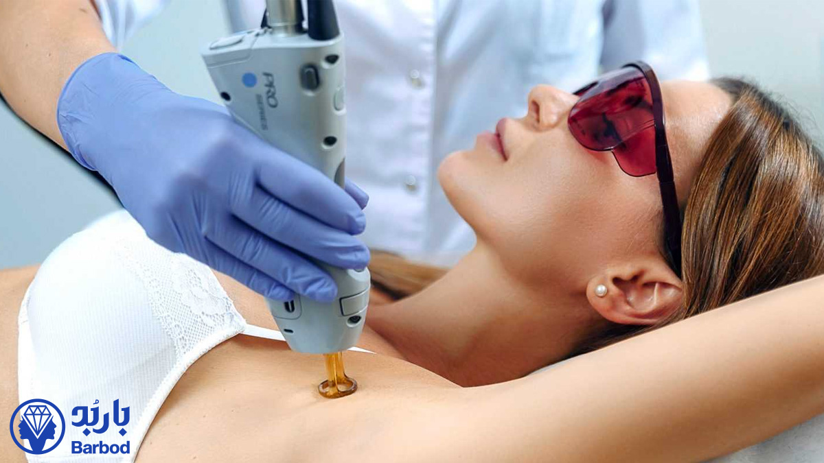 لیزر موهای زائد زیر بغل در تهران