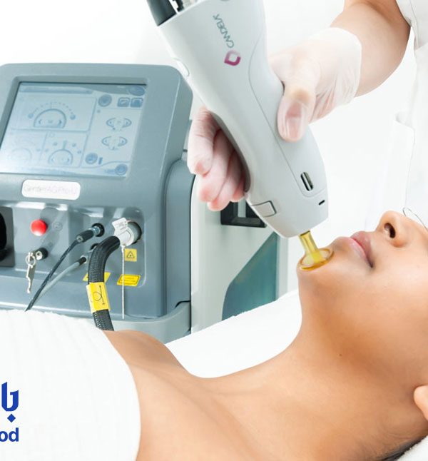 مضرات-لیزر-موهای-زائد؛-لیزر-موهای-زائد-برای-چه-کسانی-مضر-است؟