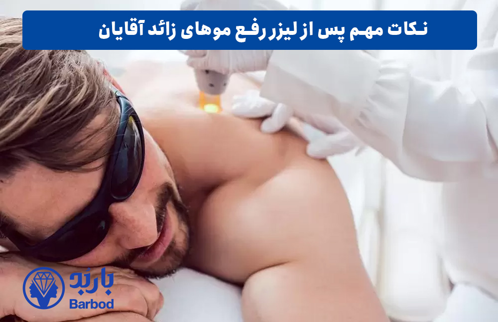 نکات مهم لیزر موهای زائد اقایان