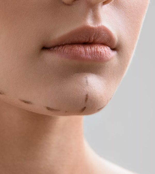 کانتورینگ صورت در تهران