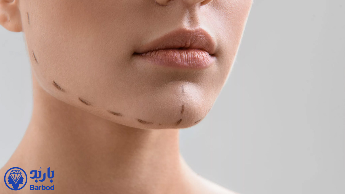 کانتورینگ صورت در تهران