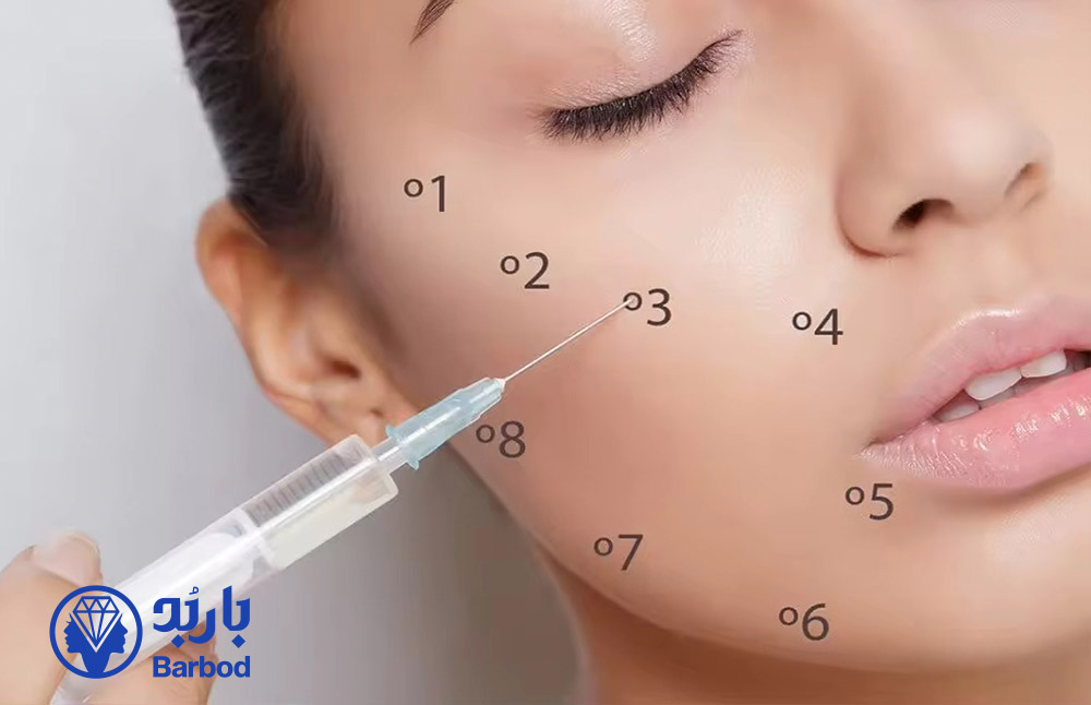 فیلر-گونه-در-تهران.-cover