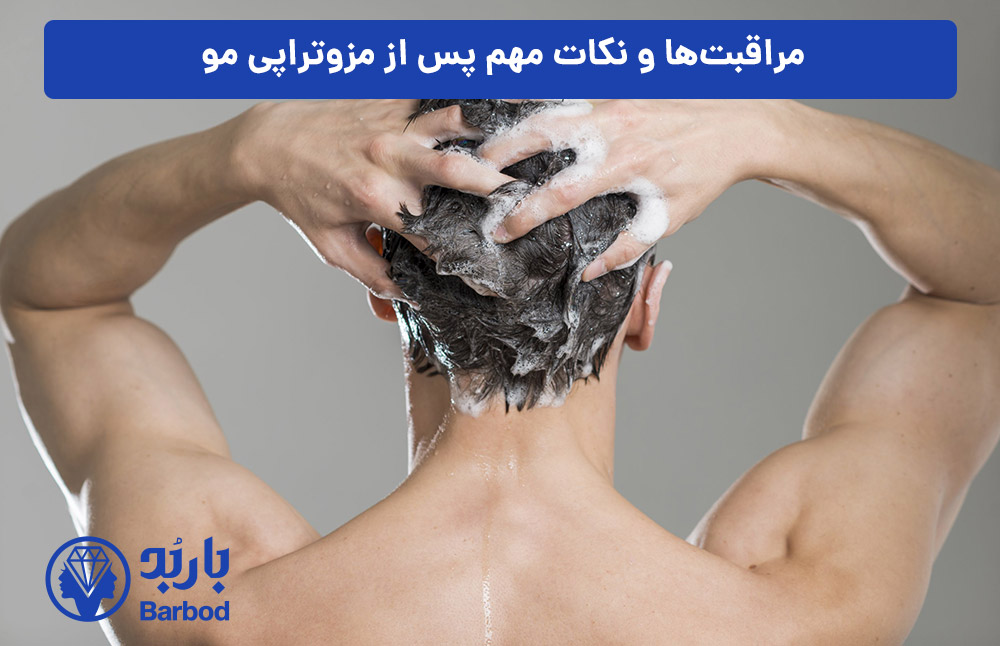 مراقبت‌ها-و-نکات-مهم-پس-از-مزوتراپی-مو