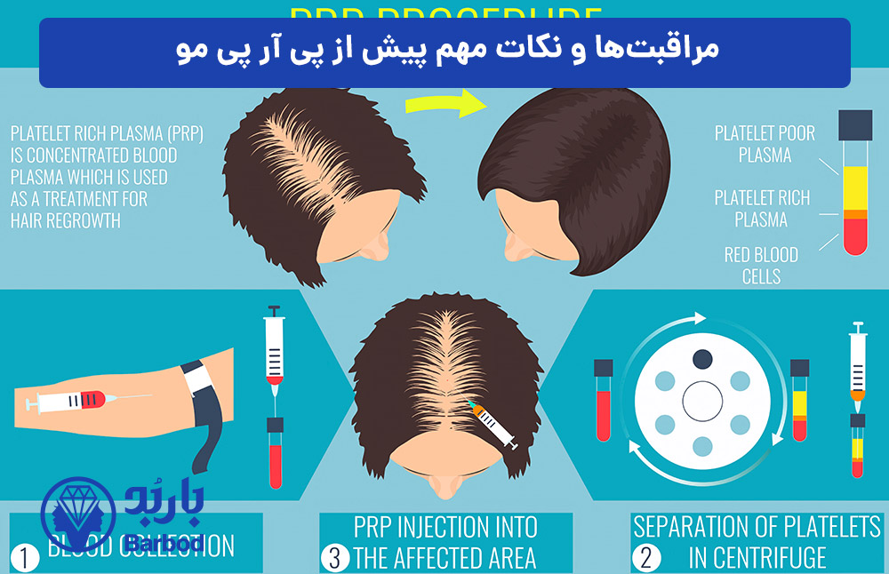مراقبت‌ها-و-نکات-مهم-پیش-از-پی-آر-پی-مو