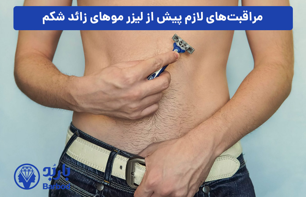 مراقبت‌های-لازم-پیش-از-لیزر-موهای-زائد-شکم