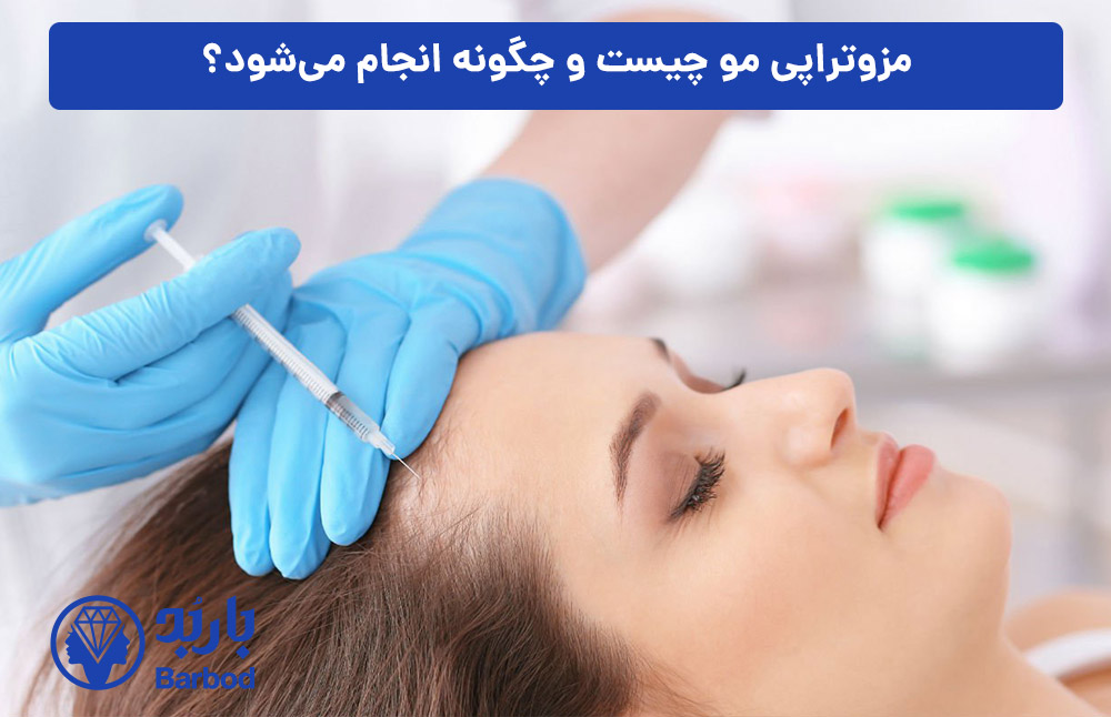 مزوتراپی-مو-چیست-و-چگونه-انجام-می‌شود؟