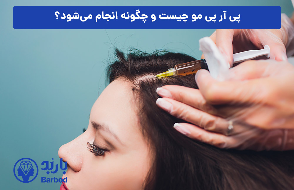 پی-آر-پی-مو-چیست-و-چگونه-انجام-می‌شود؟