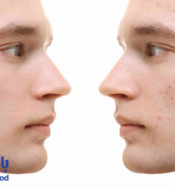 سابسیژن-در-تهران