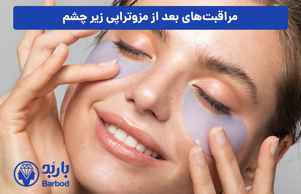 مراقبت‌های-بعد-از-مزوتراپی-زیر-چشم