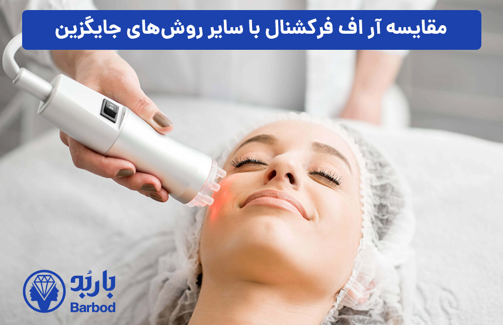 مقایسه-آر-اف-فرکشنال-با-سایر-روش‌های-جایگزین