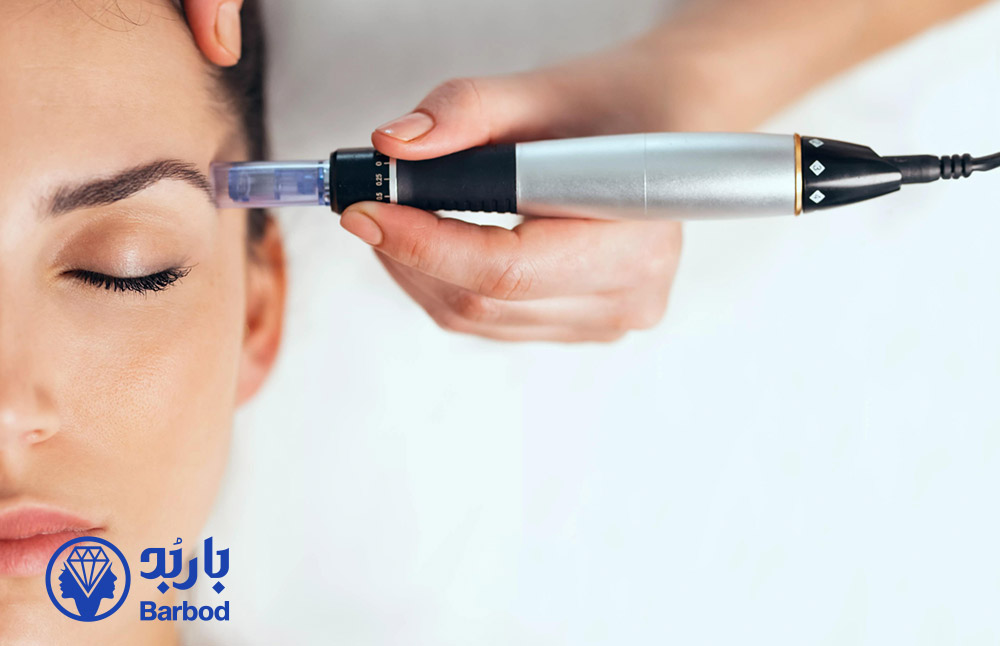 میکرونیدلینگ-در-تهران