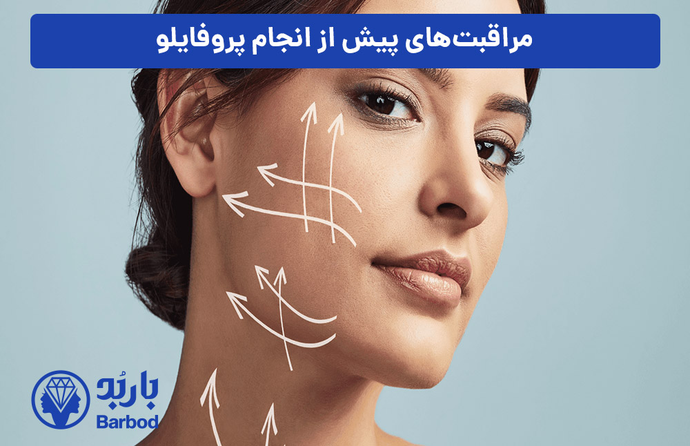 مراقبت‌های-پیش-از-انجام-پروفایلو