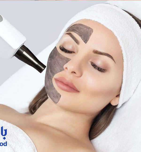 مزایای-پیلینگ-هالیوودی-برای-پوست-چرب-و-جوش‌دار