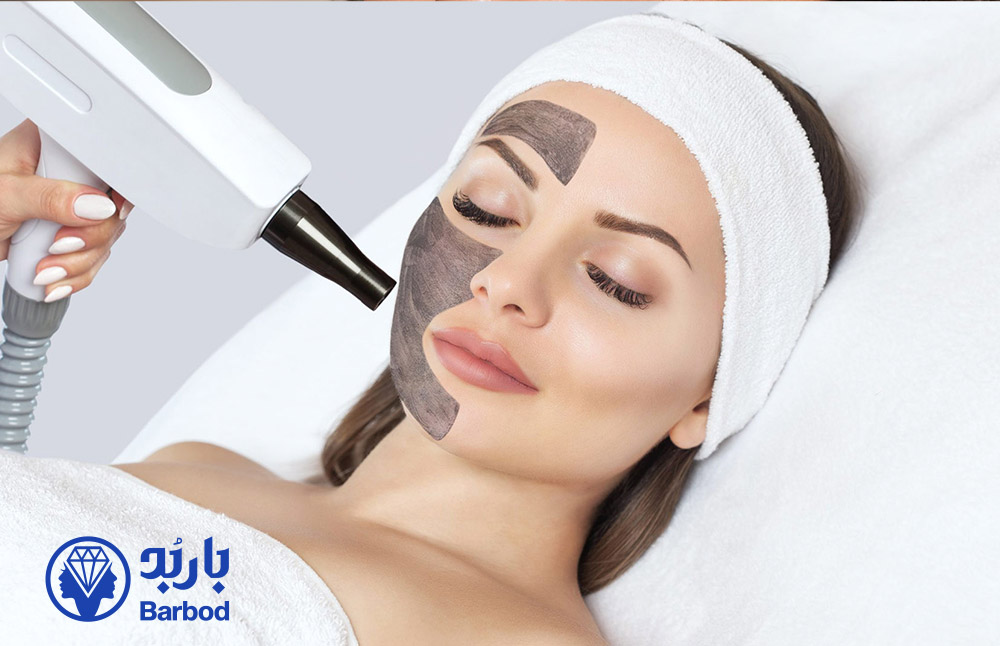 مزایای پیلینگ هالیوودی برای پوست چرب و جوش‌دار