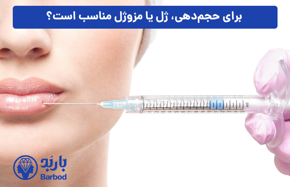 برای-حجم‌دهی،-ژل-یا-مزوژل-مناسب‌-است؟ 