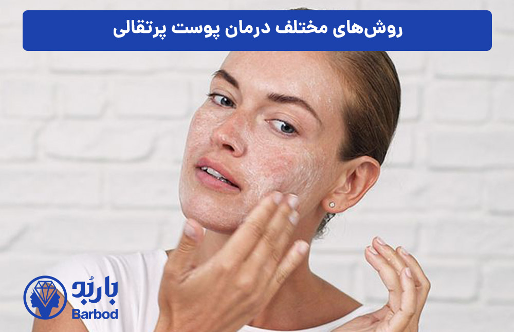 روش‌های-مختلف-درمان-پوست-پرتقالی