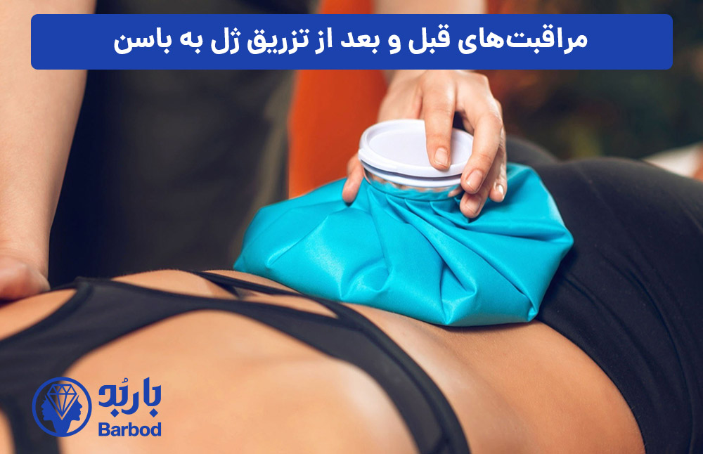 مراقبت‌های-قبل-و-بعد-از-تزریق-ژل-به-باسن