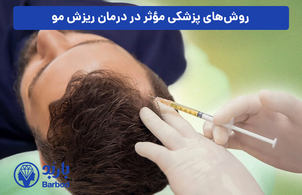 روش‌های-پزشکی-مؤثر-در-درمان-ریزش-مو