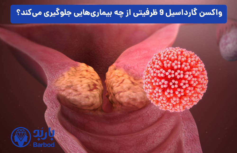 واکسن-گارداسیل-9-ظرفیتی-از-چه-بیماری‌هایی-جلوگیری-می‌کند؟