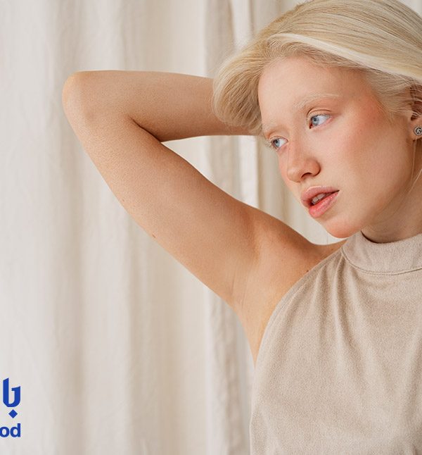 آیا موهای سفید لیزر می شود ؟