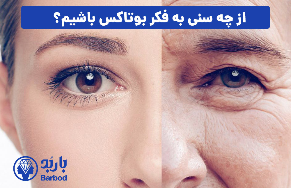 از چه سنی به فکر بوتاکس باشیم؟