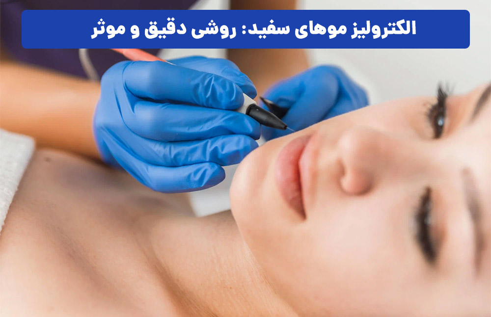 الکترولیز موهای سفید: روشی دقیق و موثر