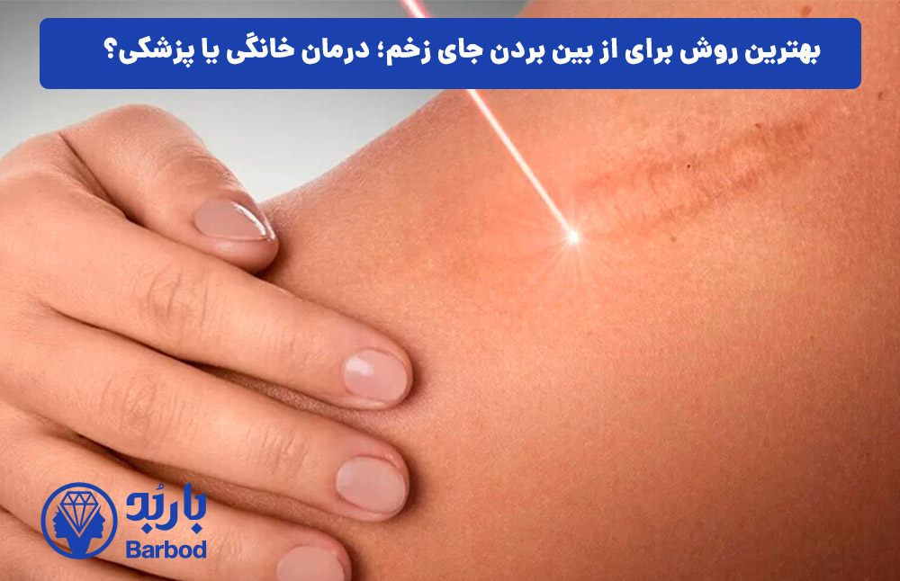 بهترین روش برای از بین بردن جای زخم؛ درمان خانگی یا پزشکی؟