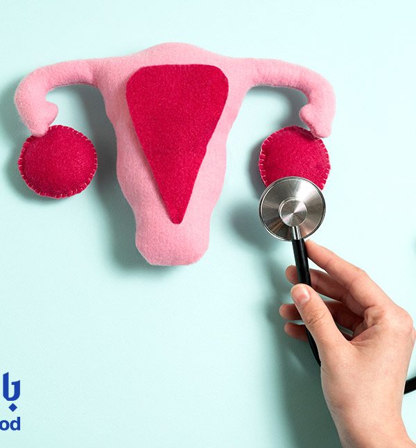 رابطه بین تخمدان پلی کیستیک و لیزر موهای زائد