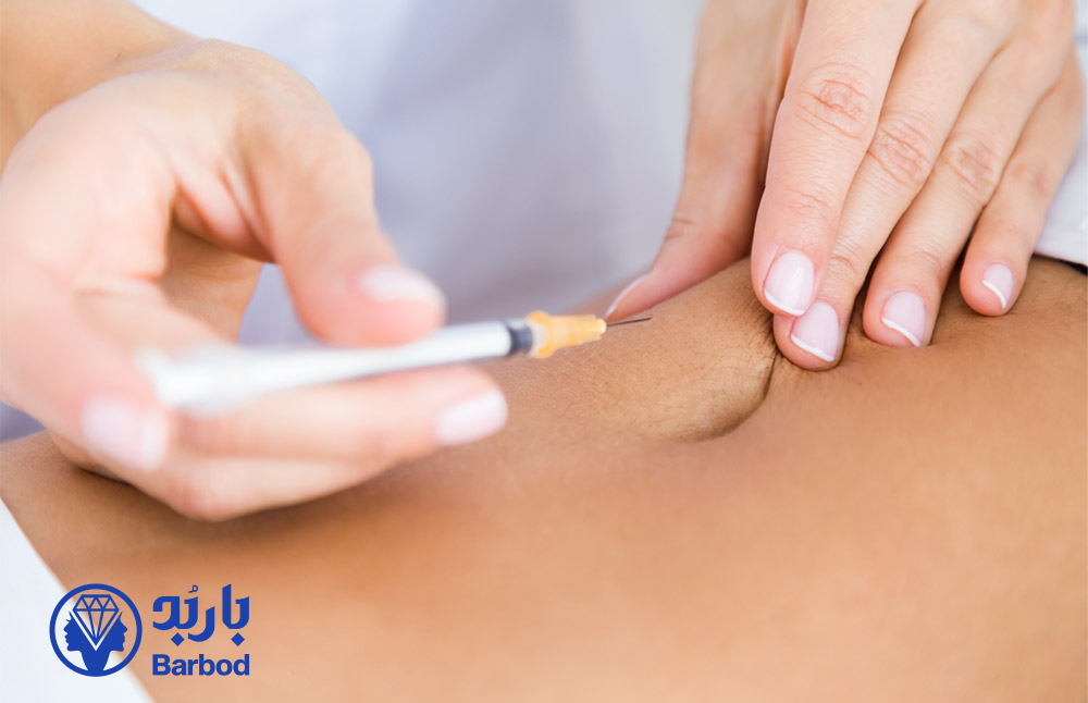 مزوتراپی و لاغری