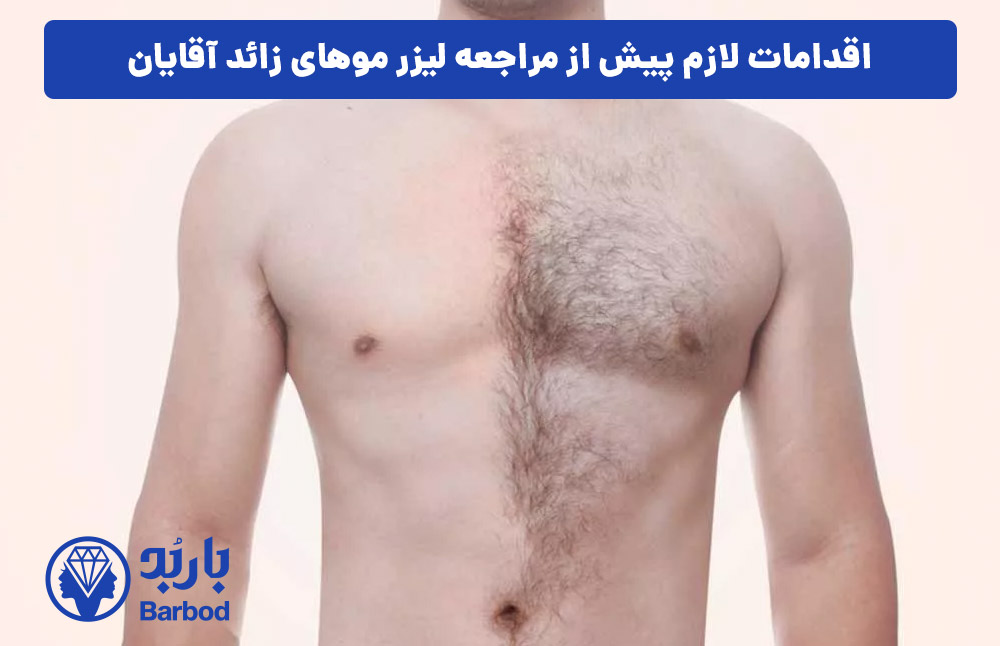 اقدامات-لازم-پیش-از-مراجعه-لیزر-موهای-زائد-آقایان