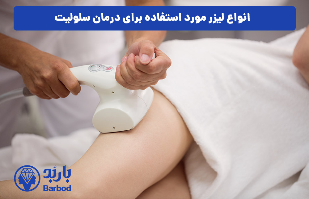 انواع لیزر مورد استفاده برای درمان سلولیت