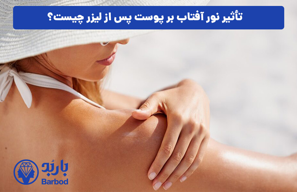 تأثیر نور آفتاب بر پوست پس از لیزر چیست؟