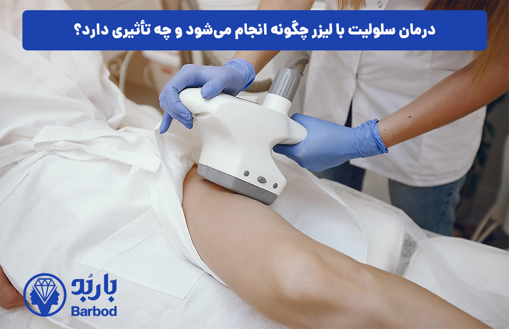 درمان سلولیت با لیزر چگونه انجام می‌شود و چه تأثیری دارد؟