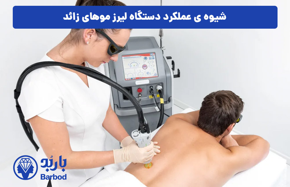 شیوه-ی-عملکرد-دستگاه-لیرز-موهای-زائد