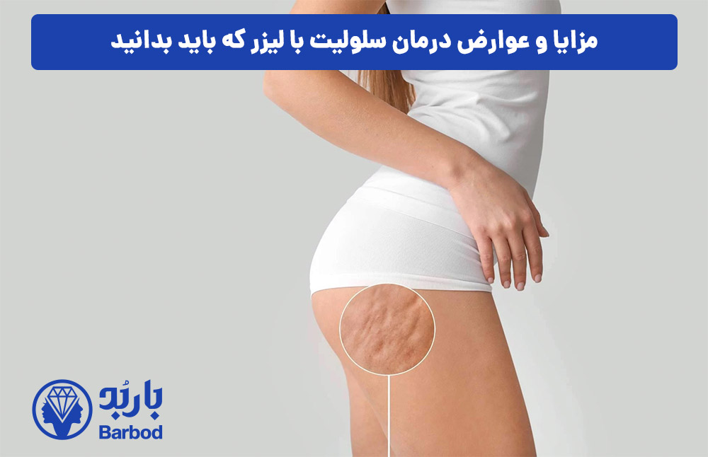مزایا و عوارض درمان سلولیت با لیزر که باید بدانید