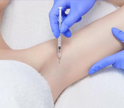 بوتاکس زیر بغل در تهران