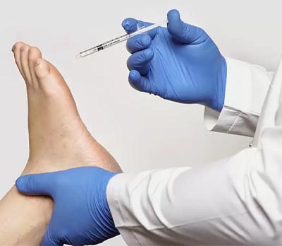 بوتاکس کف پا در تهران