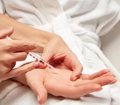 بوتاکس کف دست