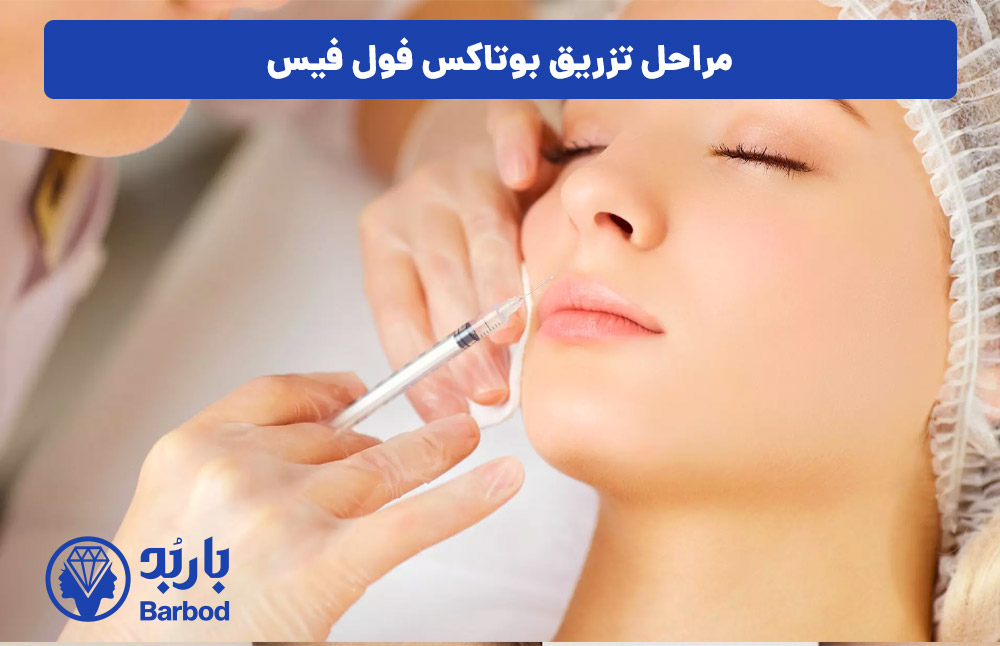 مراحل-تزریق-بوتاکس-فول-فیس