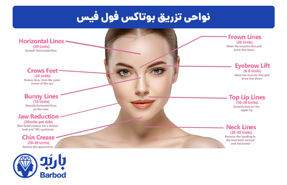 نواحی-تزریق-بوتاکس-فول-فیس