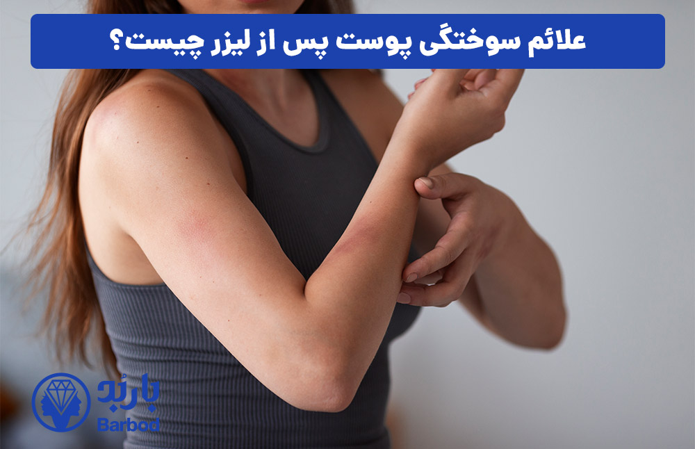 علائم سوختگی پوست پس از لیزر چیست؟