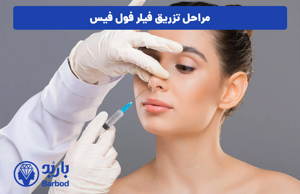 مراحل تزریق فیلر فول فیس در تهران