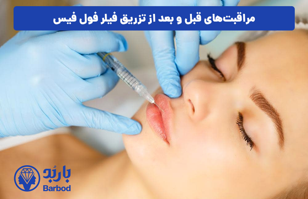 مراقبت‌های قبل و بعد از تزریق فیلر فول فیس