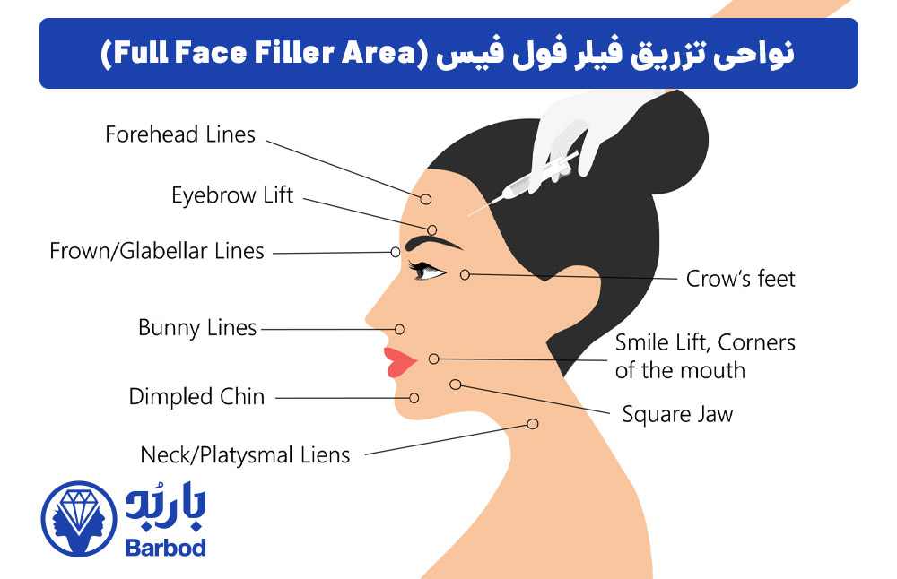 نواحی تزریق فیلر فول فیس