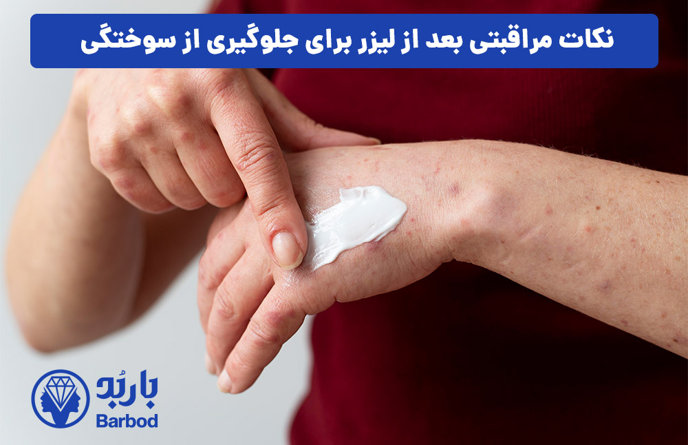 نکات مراقبتی بعد از لیزر برای جلوگیری از سوختگی